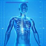 How Can You Prevent Osteoporosis Naturally?