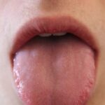 What Your Tongue Says About Your Health