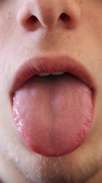 What Your Tongue Says About Your Health