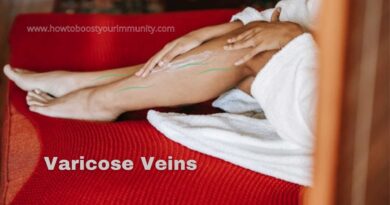 Home Remedies To Get Rid Of Varicose Veins