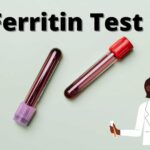 What is Ferritin? What Causes Ferritin Deficiency?